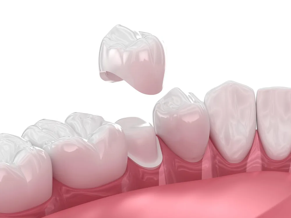 Dental care at Finch Midland Dental