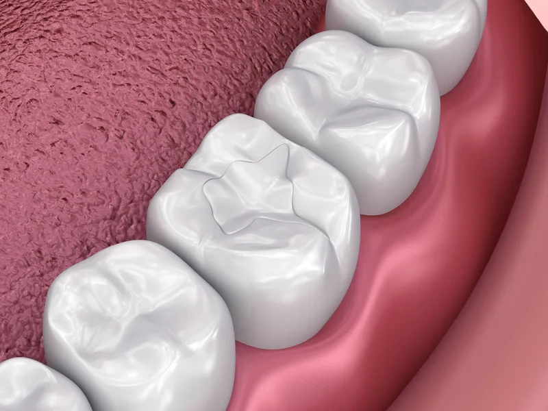 Dental treatment in Scarborough