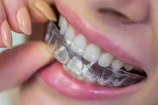 Smiling teenage girl with braces sitting in dental chair while dentist stands in clinic